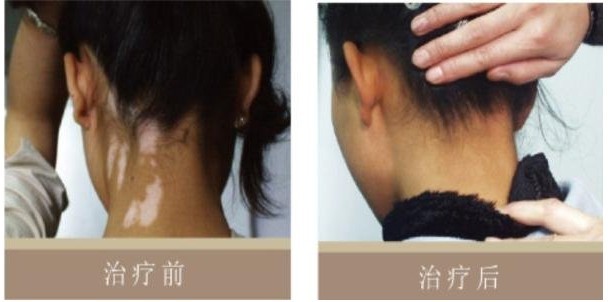 ����ǰ��Ա�ͼ